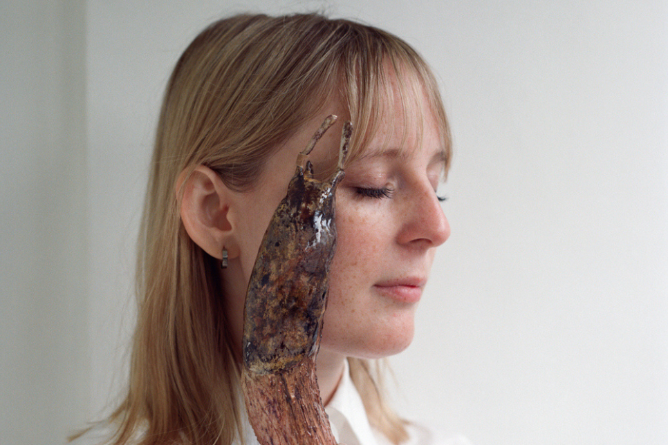 Photograph of a woman with a large slug on the side of her face / Ffotograff o fenyw sydd â malwen fawr ar ochr ei wyneb